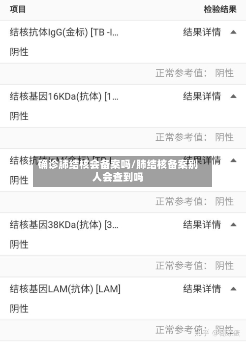 确诊肺结核会备案吗/肺结核备案别人会查到吗
