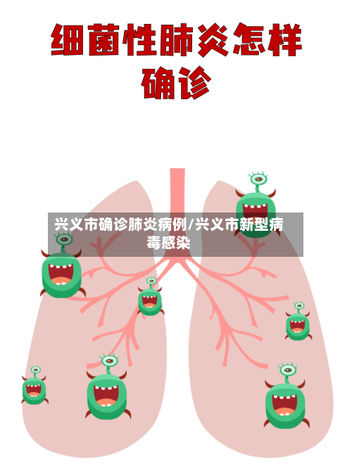 兴义市确诊肺炎病例/兴义市新型病毒感染