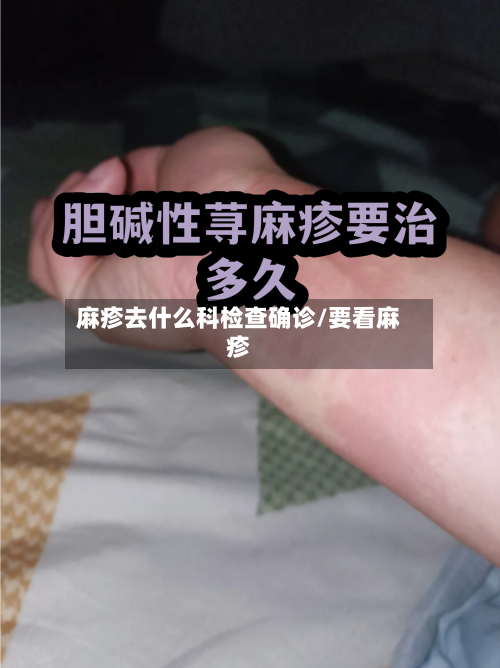 麻疹去什么科检查确诊/要看麻疹-第2张图片