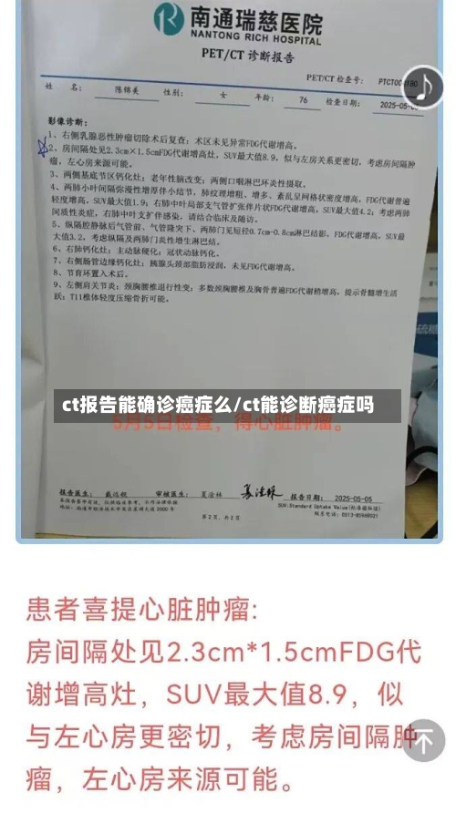 ct报告能确诊癌症么/ct能诊断癌症吗-第3张图片