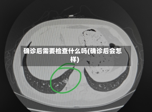 确诊后需要检查什么吗(确诊后会怎样)