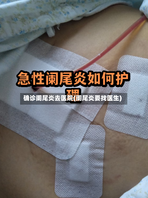 确诊阑尾炎去医院(阑尾炎要找医生)-第2张图片