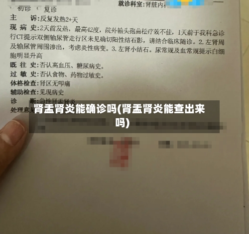肾盂肾炎能确诊吗(肾盂肾炎能查出来吗)