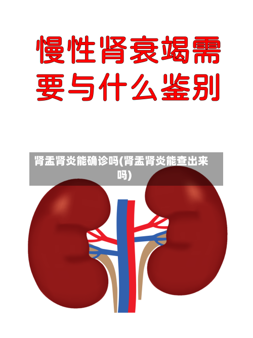 肾盂肾炎能确诊吗(肾盂肾炎能查出来吗)-第3张图片