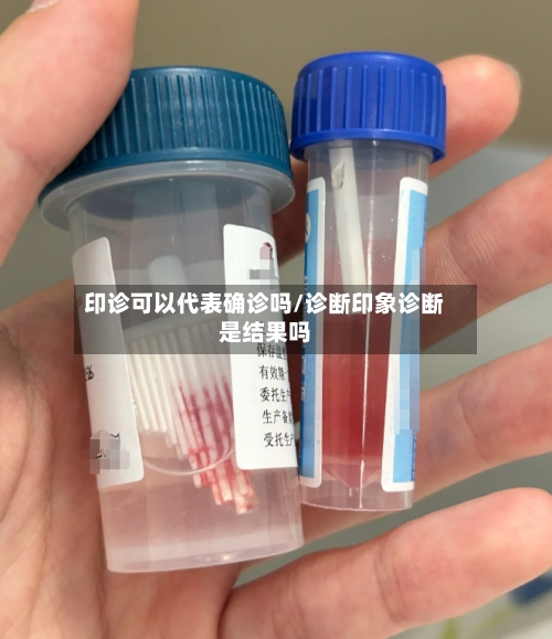 印诊可以代表确诊吗/诊断印象诊断是结果吗
