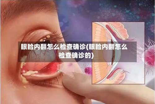 眼睑内翻怎么检查确诊(眼睑内翻怎么检查确诊的)-第2张图片