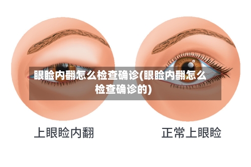 眼睑内翻怎么检查确诊(眼睑内翻怎么检查确诊的)-第3张图片