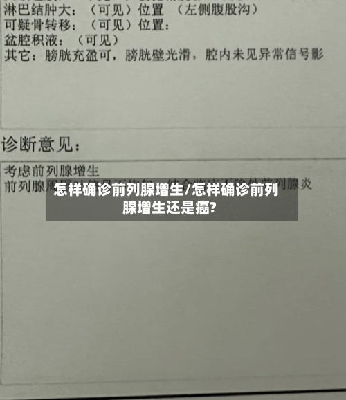 怎样确诊前列腺增生/怎样确诊前列腺增生还是癌?