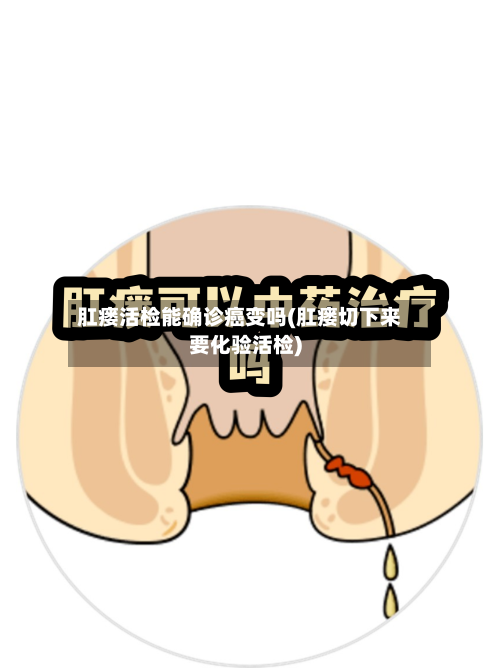 肛瘘活检能确诊癌变吗(肛瘘切下来要化验活检)