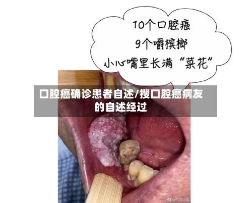 口腔癌确诊患者自述/搜口腔癌病友的自述经过