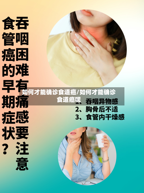 如何才能确诊食道癌/如何才能确诊食道癌呢-第2张图片