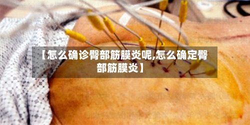 【怎么确诊臀部筋膜炎呢,怎么确定臀部筋膜炎】-第3张图片