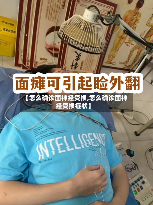 【怎么确诊面神经受损,怎么确诊面神经受损症状】-第2张图片