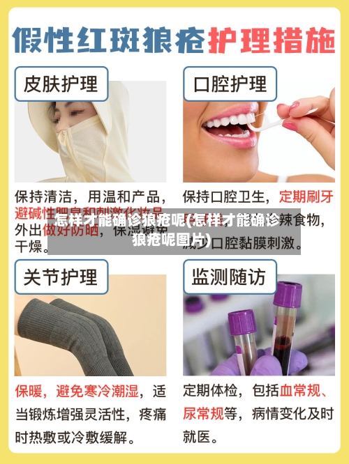 怎样才能确诊狼疮呢(怎样才能确诊狼疮呢图片)