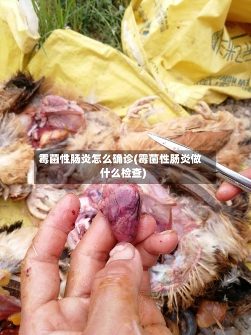 霉菌性肠炎怎么确诊(霉菌性肠炎做什么检查)-第2张图片