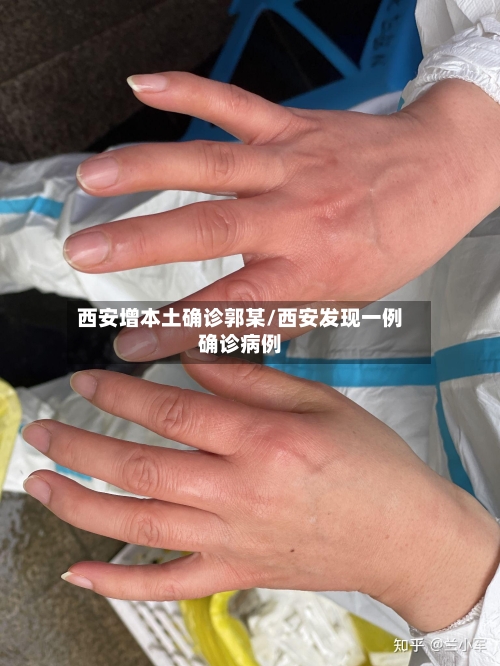 西安增本土确诊郭某/西安发现一例确诊病例-第2张图片
