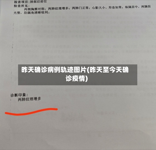 昨天确诊病例轨迹图片(昨天至今天确诊疫情)