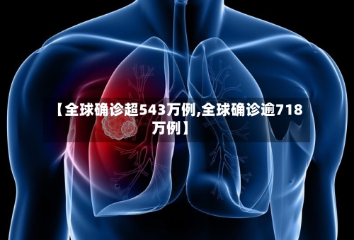 【全球确诊超543万例,全球确诊逾718万例】-第2张图片