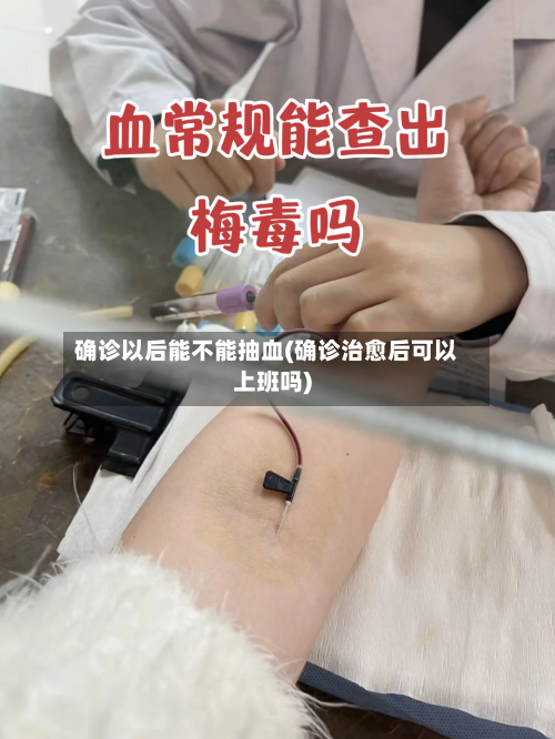 确诊以后能不能抽血(确诊治愈后可以上班吗)-第2张图片