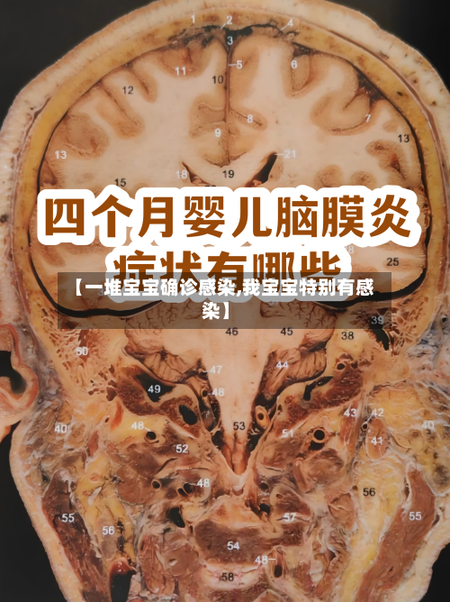 【一堆宝宝确诊感染,我宝宝特别有感染】