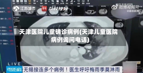天津医院儿童确诊病例(天津儿童医院病例询问电话)-第3张图片