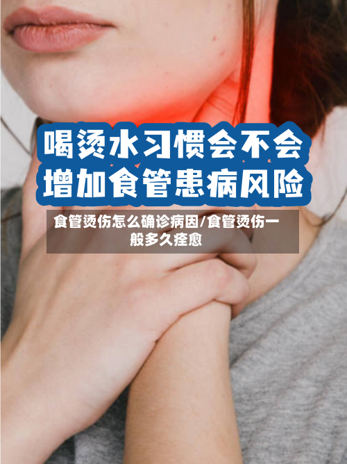 食管烫伤怎么确诊病因/食管烫伤一般多久痊愈