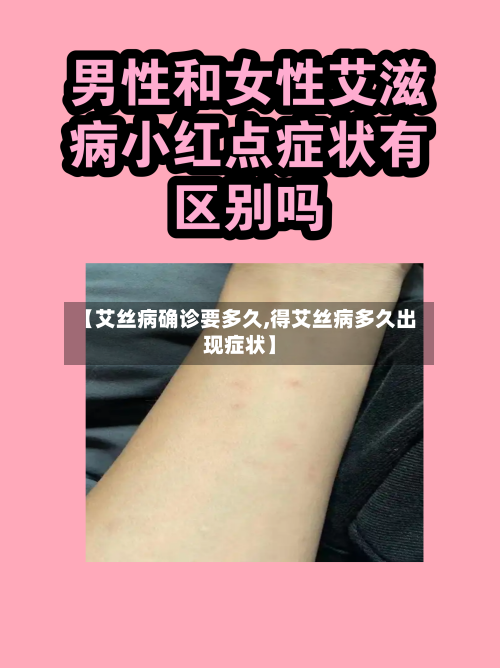【艾丝病确诊要多久,得艾丝病多久出现症状】