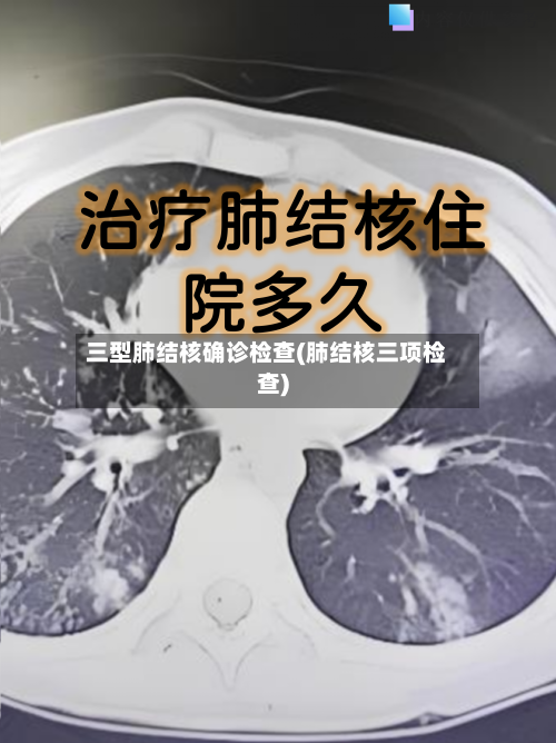 三型肺结核确诊检查(肺结核三项检查)