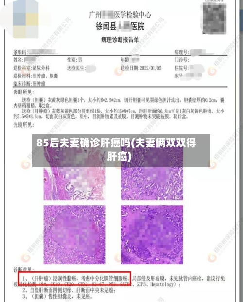 85后夫妻确诊肝癌吗(夫妻俩双双得肝癌)