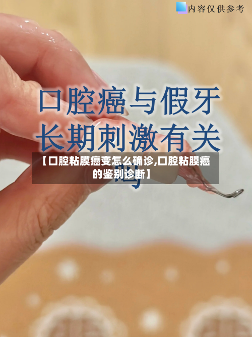 【口腔粘膜癌变怎么确诊,口腔粘膜癌的鉴别诊断】-第2张图片