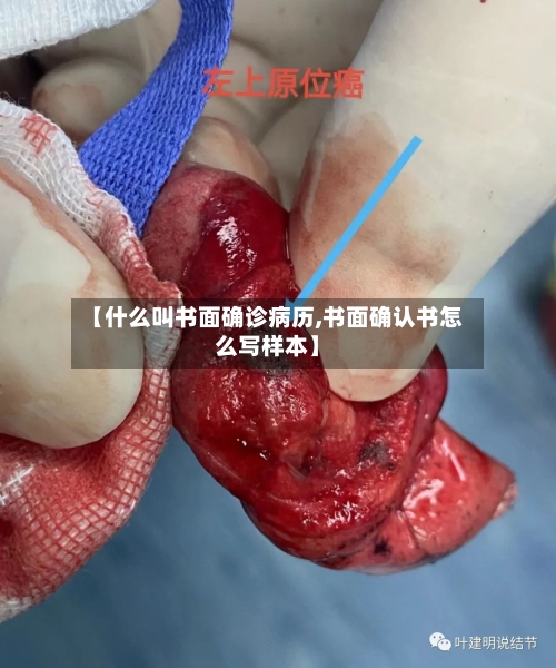 【什么叫书面确诊病历,书面确认书怎么写样本】-第2张图片