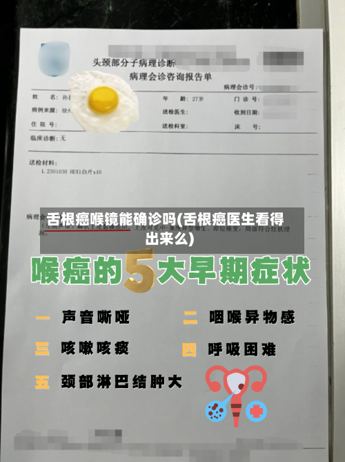 舌根癌喉镜能确诊吗(舌根癌医生看得出来么)-第2张图片