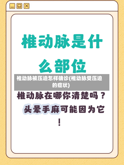 椎动脉被压迫怎样确诊(椎动脉受压迫的症状)