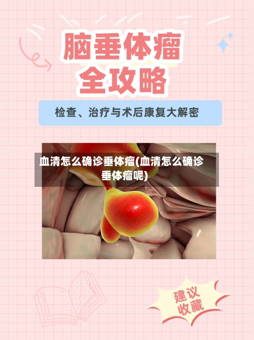 血清怎么确诊垂体瘤(血清怎么确诊垂体瘤呢)